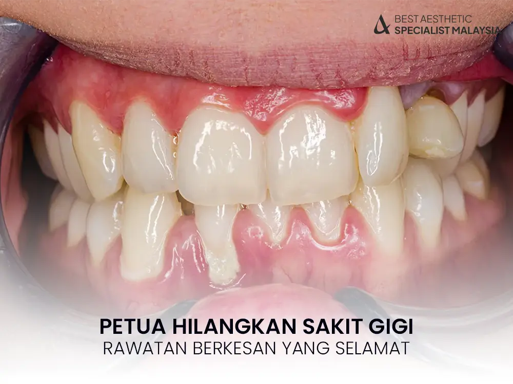 petua-hilangkan-sakit-gigi