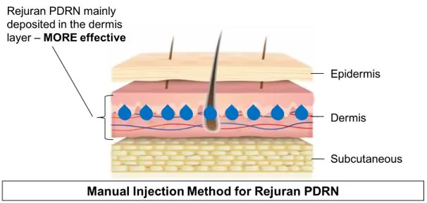 rejuran