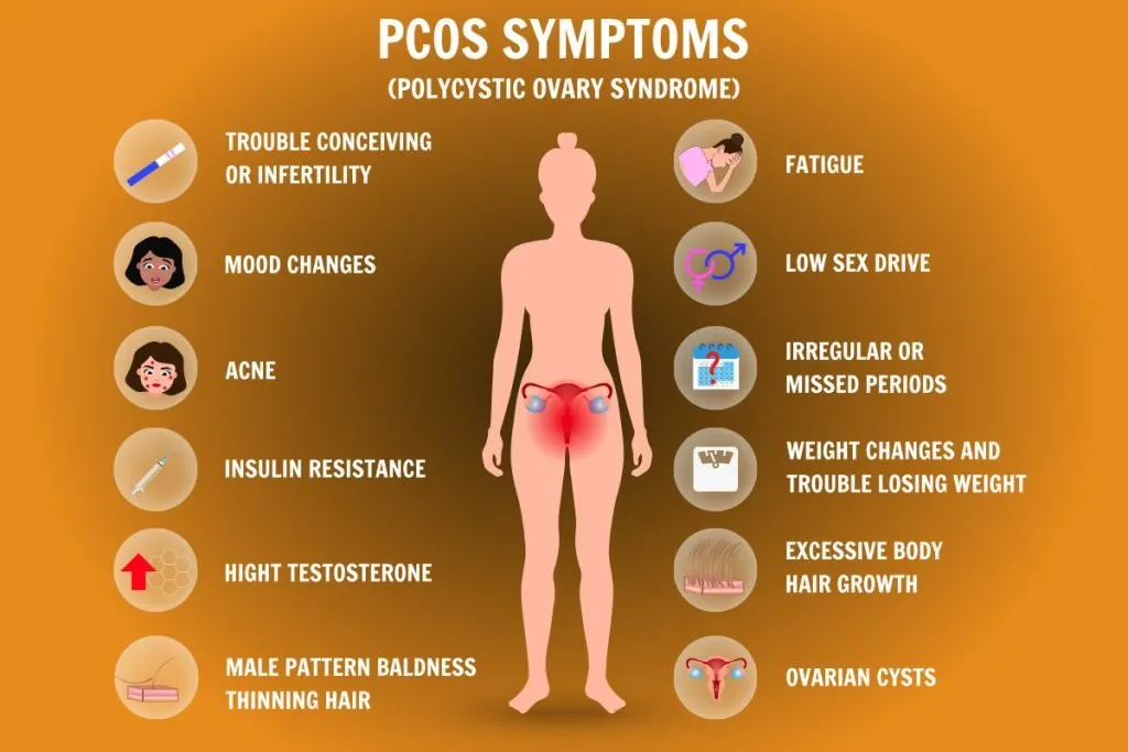 simptom-PCOS