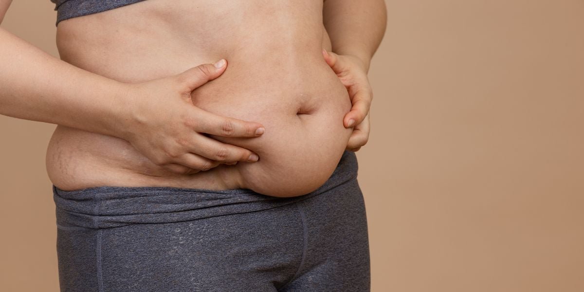 belly-fat