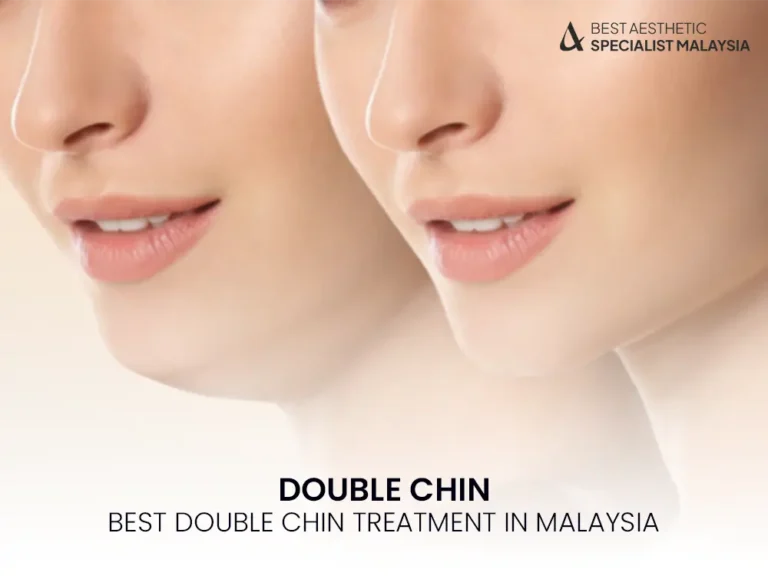 double-chin-treatment-malaysia