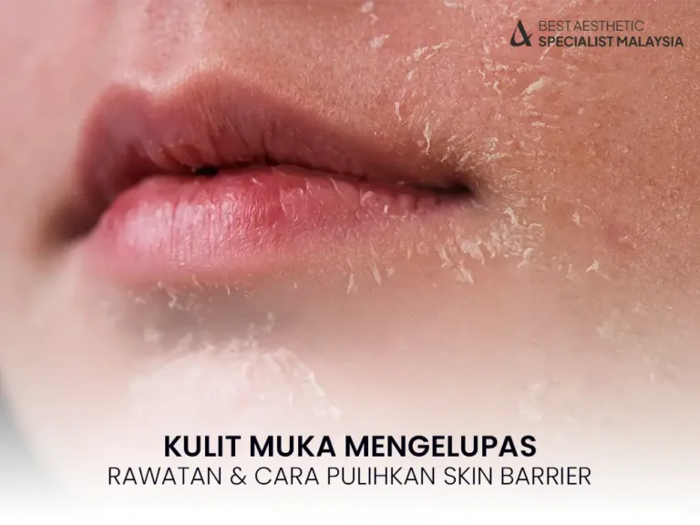 kulit-muka-mengelupas