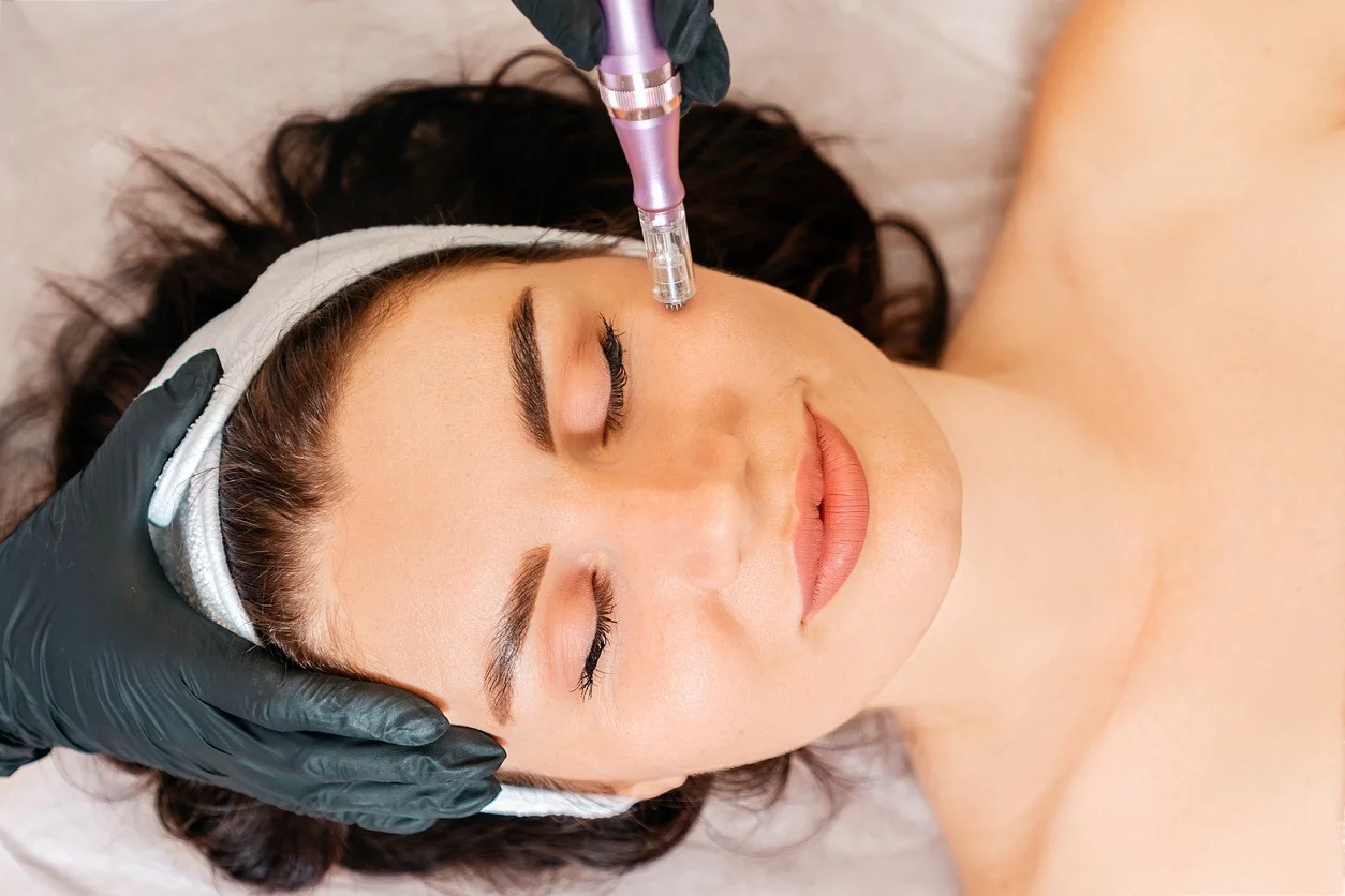microneedling-malaysia