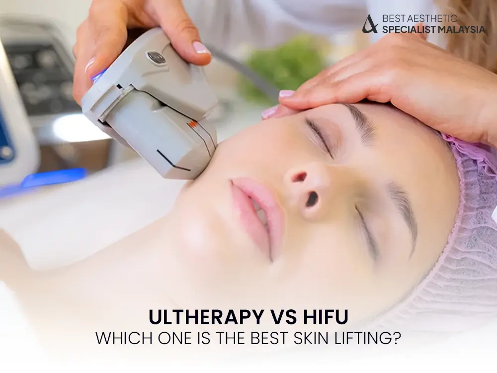 Ultherapy vs HIFU: Which One Is The Best Skin Lifting? 9 ULTHERAPY VS HIFU