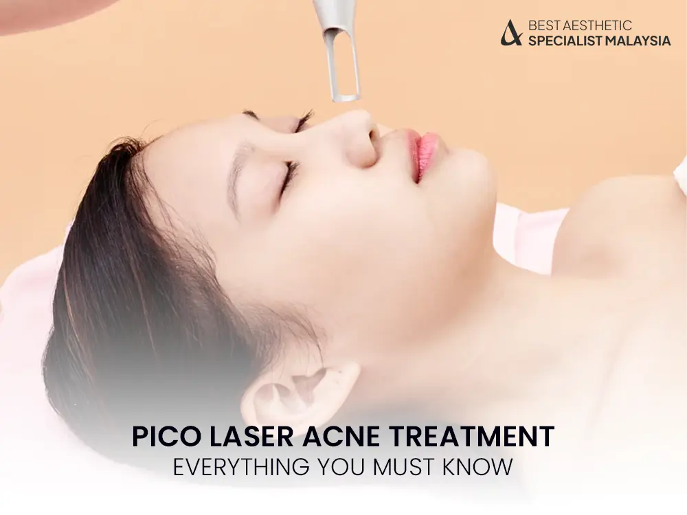 Pico Laser Acne Treatment: Everything You Must Know 7 pico laser acne treatment benefits