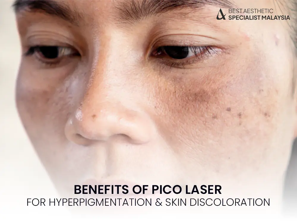 Benefits of Pico Laser for Hyperpigmentation & Skin Discoloration 11 pico laser for hyperpigmentation