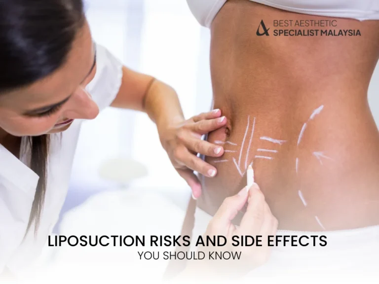 liposuction-risks
