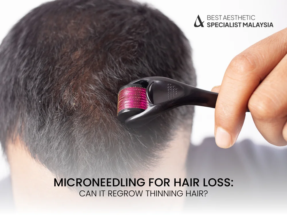 microneedling-for-hair-loss