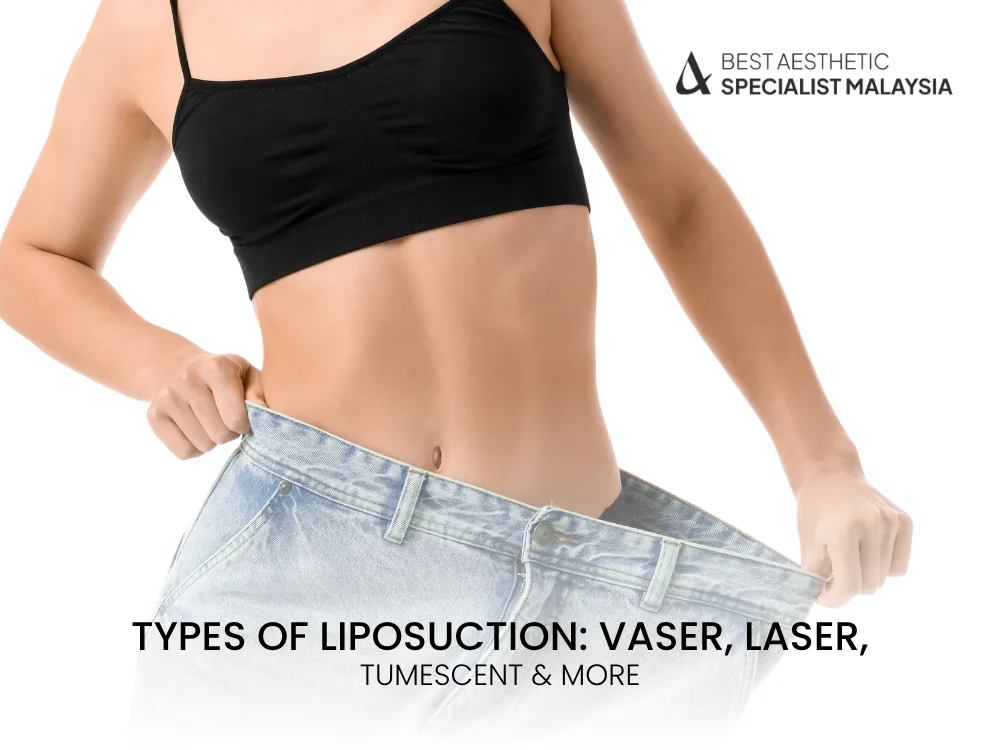 types-of-liposuction